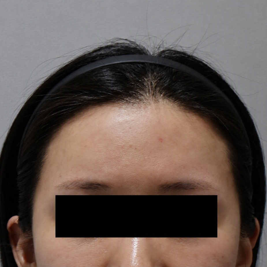 After
