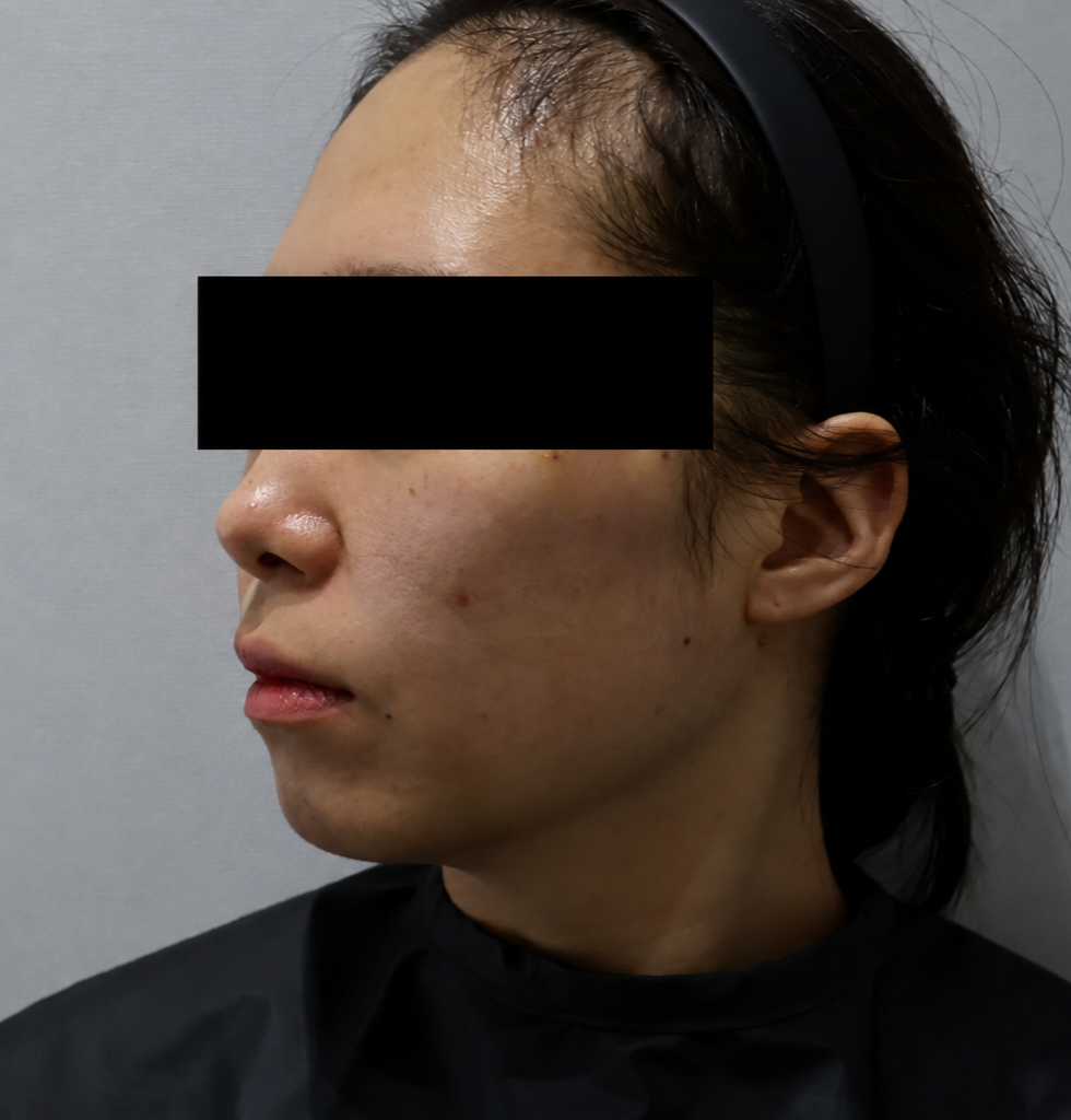 After